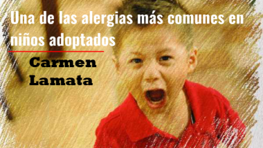 Una de las alergias más comunes en niños adoptados. Por Carmen Lamata